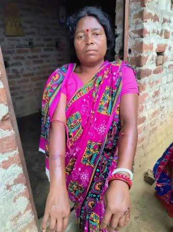 पटमदा: कुत्ते के काटने पर महिला ने दिखाई हिम्मत, जबड़ा फाड़कर मार डाला, आवारा कुत्तों ने 2 दिनों में 30 से अधिक लोगों को किया घायल