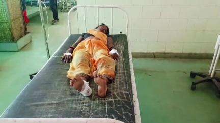 रीठी: पाली के पास बाइक सवार महिला को तेज रफ्तार बाइक ने मारी टक्कर, महिला घायल, इलाज जारी