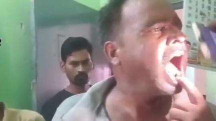 बिसवां: थानगांव के शुक्लन पुरवा मजरा परसिया गांव में जमीनी विवाद को लेकर दो सगे भाइयों में हुई मारपीट, एक पक्ष के दो लोग घायल