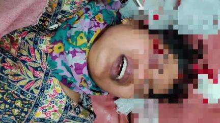 केराकत: चोरसंड गांव में खेत में बकरी घुसने पर हुआ झगड़ा, दबंगों ने पिता-पुत्री को पीटा