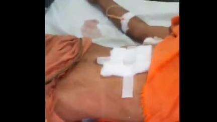 तमकुही राज: गोसाई पट्टी में आर्केस्ट्रा देखने आए मनबढ़ युवकों ने एक युवक को चाकू मारा, गंभीर स्थिति में मेडिकल कॉलेज में भर्ती
