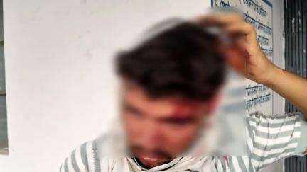 पोरसा: ओरेठी गांव के पास युवकों ने ई-रिक्शा से उतारकर एक युवक को पीटा, सर फटने से हालत गंभीर