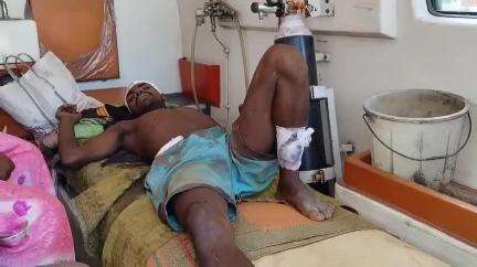 चाईबासा: सिरजन गांव में जंगल में पत्थर तोड़ते समय मिट्टी धंसने से मलबे में दबकर युवक घायल