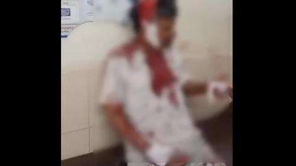 काटोल: राऊतपुरा येथे  एका व्यक्तीवर जीवघेणा हल्ला, आरोपी पोलिसांच्या ताब्यात