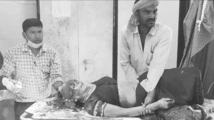 नागौद: इटमा गांव के पास बस की टक्कर से बाइक सवार महिला घायल, सतना के जिला अस्पताल में भर्ती