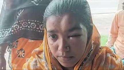 দেগঙ্গা: জমি জমা সংক্রান্ত বিবাদকে কেন্দ্র করে গৃহবধূকে কোদালের বাট দিয়ে মারার অভিযোগ, তদন্তে পুলিশ