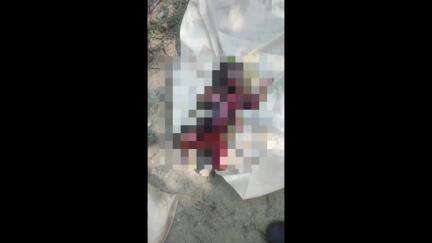एटा: मानवता को शर्मसार करने वाली तस्वीरें, नवजात बच्ची को जन्म देकर कलयुगी मां गांव सर्रा भट्टा समीप फेंक कर हुई फरार