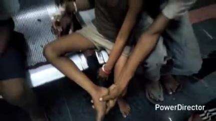 कटिहार: मुसापुर में खेलते समय नाबालिग को जहरीले सांप ने काटा, अस्पताल में भर्ती