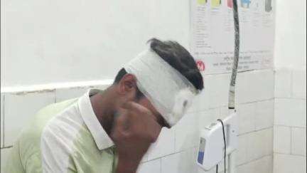 जमुआ: चुनज़का निवासी रितेश पासवान सड़क हादसे में घायल, सदर अस्पताल में इलाज जारी