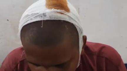 साहेबपुर कमाल: रसलपुर बहलोरिया में छत पर चदरा चढ़ाने के विवाद में युवक से मारपीट, सिर फोड़ा
