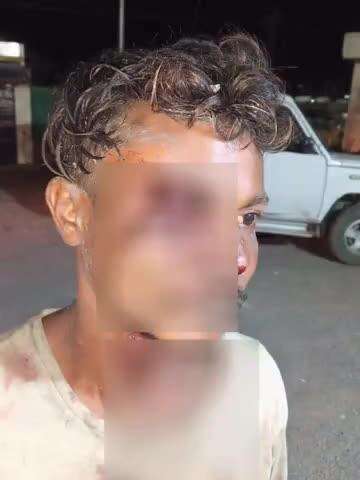 पंडरिया: ग्राम नेउरगांव में दो लोगों के बीच जमकर मारपीट, एक युवक घायल, बोड़ला अस्पताल में भर्ती