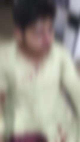 कैसरबाग चौराहे पर दबंगों ने एक युवक को जमकर मारा-पीटा, पुलिस में की गई शिकायत