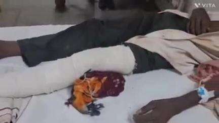 बागीदौरा: टिमेडा गांव में निर्माणाधीन मकान की छत पर काम करते समय 45 वर्षीय व्यक्ति का पैर स्लिप होने से गंभीर चोट लगी