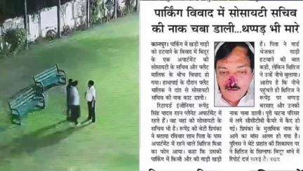 उत्तर प्रदेश : कानपुर की सोसाइटी में पार्किंग विवाद को लेकर एक शख्स ने दांत से रूपेंद्र सिंह यादव की नाक चबा ली।