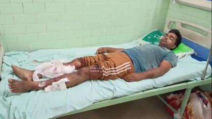 बरेली: थाना फरीदपुर क्षेत्र के मोहल्ला मिरधान निवासी युवक का आरोप, ससुराल पक्ष के लोगों ने की मारपीट