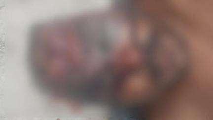 সিউড়ি ১: পথ দুর্ঘটনায় মৃত্যু হওয়া এক ব্যক্তির মৃতদেহ ময়না তদন্ত করানো হলো সিউড়ি সদর হাসপাতালে