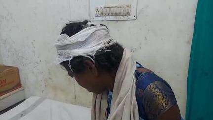 डिंडौरी: छिन्दहन चरगांव में पति-पत्नी के बीच विवाद, गुस्से में पति ने पत्नी पर हंसिया से किया हमला