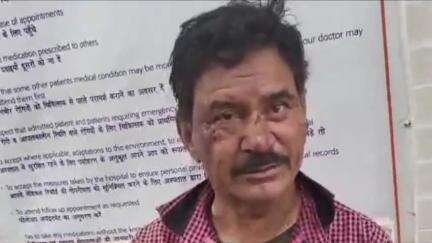 सिवनी: पलारी चौकी के सिवनी रोड पर तेज रफ्तार बाइक हुई दुर्घटनाग्रस्त, चालक हुआ घायल
