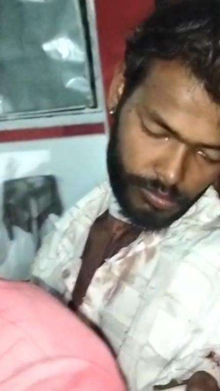 मेरठ: लिसाड़ीगेट थाना क्षेत्र में पत्नी ने पति पर धारदार हथियार से किया हमला, पति की गर्दन कटी, अस्पताल में भर्ती