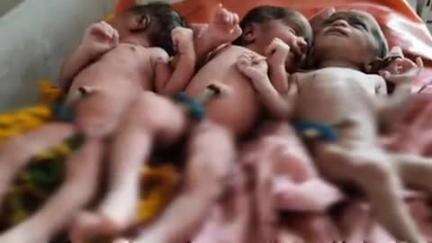 मानपुर: अमरपुर के प्राथमिक स्वास्थ्य केंद्र में महिला ने एक साथ तीन बच्चियों को जन्म दिया, सभी स्वस्थ