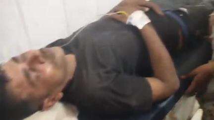 सीतापुर: मस्जिद दीनपुर कहीमारा ग्राम पंचायत में मामूली बात को लेकर दो पक्षों में जमकर मारपीट, 6 लोग घायल