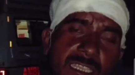 शाहजहांपुर: थाना सिधौली क्षेत्र में बीती रात काम करके घर लौट रहे युवक पर दबंगों ने किया हमला, युवक गंभीर रूप से घायल