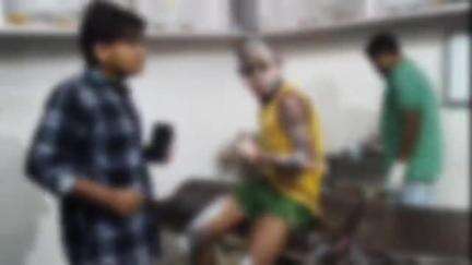 बेगूसराय: बेगूसराय में आग लगने से एक युवक झुलसा, गंभीर रूप से घायल, पुलिस जांच में जुटी
