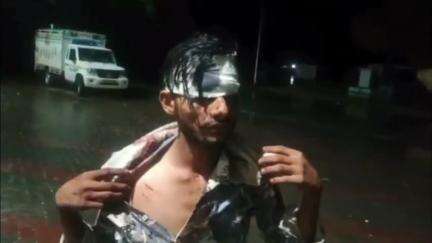 आबू रोड: आबूरोड के मावल चौकी के पास एक होटल पर पर्यटकों के साथ हुई मारपीट, बियर की बोतल से एक पर्यटक गंभीर घायल