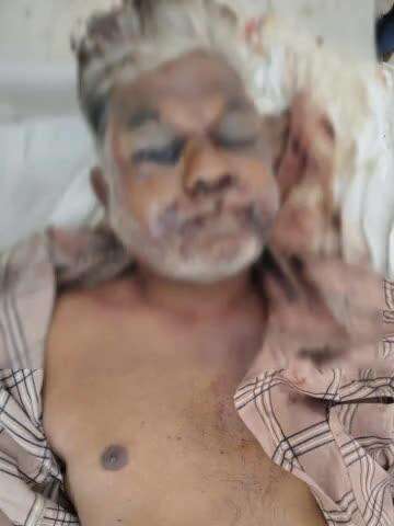 నిజామాబాద్ రూరల్: నగరంలోని ప్రభుత్వాసుపత్రిలో చికిత్స పొందుతూ వ్యక్తి మృతి, దర్యాప్తు చేపట్టిన డిచ్పల్లి పోలీసులు