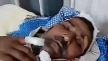 बथनाहा: सहियारा में चाचा-भतीजे के साथ मारपीट, दोनों अस्पताल में भर्ती