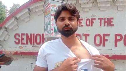 बरेली: थाना नवाबगंज क्षेत्र के ग्राम टांडा निवासी पीड़ित युवक का आरोप, दबंगों ने गाड़ी खड़ी करने को लेकर की मारपीट