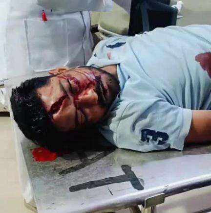बाबई: माखन नगर के तवा पुल के पास अज्ञात वाहन की टक्कर से बाइक सवार युवक गंभीर रूप से घायल