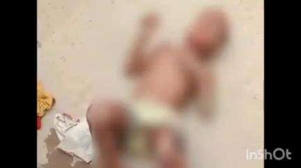 नानपारा: महरथा गांव में कुत्तों के झुंड ने दो बच्चियों पर हमला कर किया घायल, निजी अस्पताल में चल रहा है इलाज