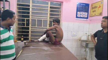 बिश्रामपुर: मालगाड़ी की चपेट में आने से युवक का पैर कटा, रेलवे पुलिस ने घायल को विश्रामपुर सीएचसी पहुंचाया