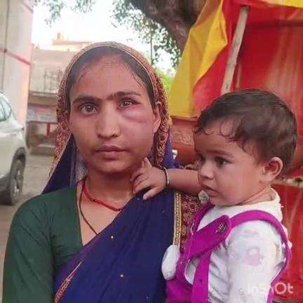 ऊंचाहार: भैरों का पुरवा मजरे कंदरांवा गांव में शराबी पति ने महिला को बेरहमी से पीटा, पीड़िता ने पुलिस से लगाई गुहार