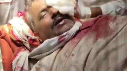 करछना: हर्रई गांव में शराब पीने से मना करने पर व्यक्ति पर बोतल तोड़कर किया हमला, शिकायत के बावजूद नहीं हुई कार्रवाई