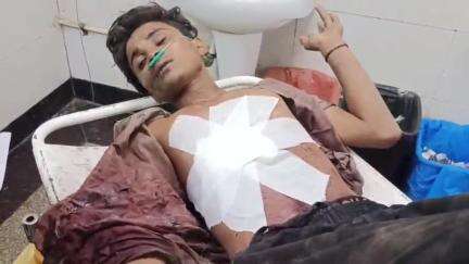 पानीपत: पानीपत के संजय चौक पर नशेड़ियों ने युवक को चाकू मारकर लूट की वारदात को अंजाम दिया