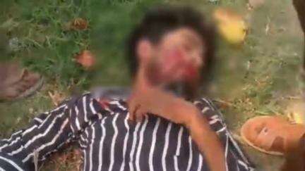 सिधौली: अनियंत्रित वाहन ने एक बाइक चालक को मारी जोरदार टक्कर, युवक का अस्पताल में इलाज जारी