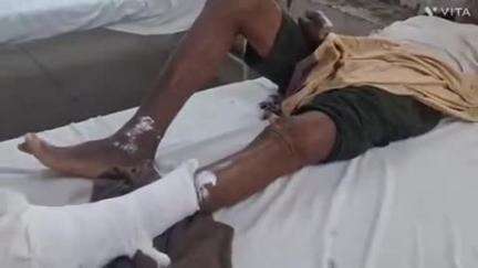 बागीदौरा: रतनपुरा गांव में बाजार से घर लौटते समय 50 वर्षीय व्यक्ति को बाइक ने मारी टक्कर, गंभीर चोट के कारण एमजी अस्पताल रेफर