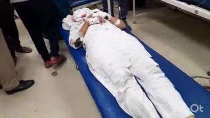 हाथरस: कस्बा मैदु फाटक के पास एक वाहन को बचाने के चलते अनियंत्रित होकर सड़क पर गिरी स्कूटी, 2 सगी बहनें हुईं घायल