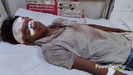 कर्वी: कर्वी के गल्ला मंडी के पास कार के दरवाजे से टकराकर बाइक सवार दो गिरे, दोनों घायल, एक जिला अस्पताल में भर्ती