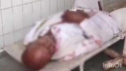 सिरोंज: भोपाल रोड पर कार को बचाने में अनियंत्रित होकर गिरी मोटरसाइकिल, ग्रामीण घायल
