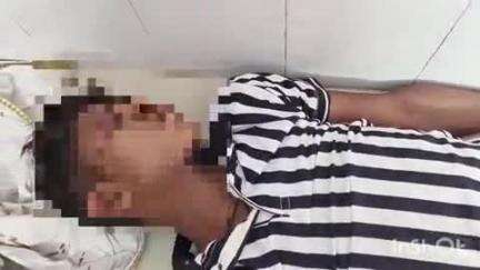 मड़ावरा: भीकमपुर के पास बाइक असंतुलित होकर गिरने से बाइक चालक घायल हुआ