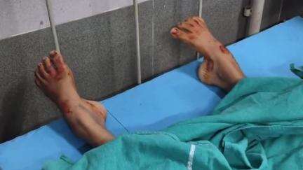 মঙ্গলকোট: মঙ্গলকোটের শ্যামবাজারে গলায় ফাঁস দিয়ে আত্মঘাতী হল কিশোরী, দেহটির ময়নাতদন্ত হল কাটোয়া,মৃত্যুর কারণ খতিয়ে দেখছে পুলিশ