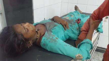 पाली: नया गांव में चचेरे भाई ने बहन के साथ की मारपीट, घायल को बांगड़ हॉस्पिटल में कराया भर्ती