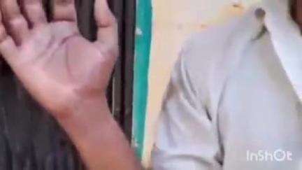 कायमगंज: गांव पहाड़पुर बैरागढ़ निवासी युवक ने थाने के दरोगा पर पटो से मारपीट करने का लगाया आरोप, युवक ने दिखाई गंभीर चोटें