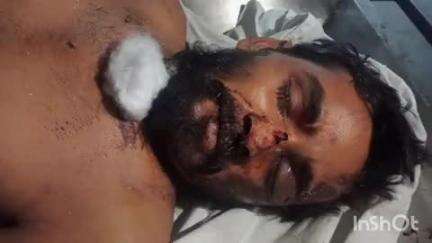 हुज़ूर: चाकघाट में दुर्घटना के बाद लाए गए युवक की इलाज के दौरान मौत, पहचान नहीं हो पाई