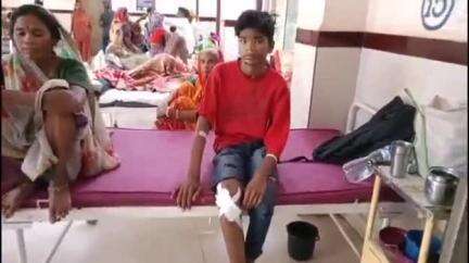 शिवपुरी नगर: देवरी गांव के पास तेज रफ्तार बाइक बस से भिड़ी, बारात से लौट रहे दो नाबालिग भाई घायल