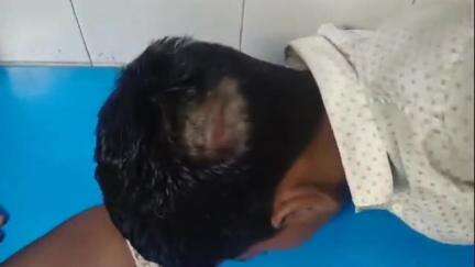 बेगूसराय: बेगूसराय के विष्णुपुर में दबंगों ने युवक से की मारपीट, पुलिस जांच में जुटी