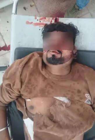 अलीराजपुर: उदयगढ़ के थांदला में बीती रात अज्ञात व्यक्ति की दुर्घटना में मौत, शिनाख्त नहीं हो पाई